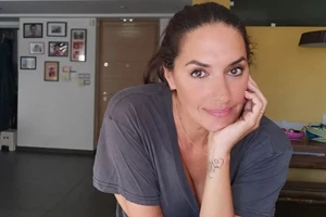 Το μπότοξ της Νόνης Δούνια | Η εναλλακτική επιλογή που προτείνει - εικόνα 2