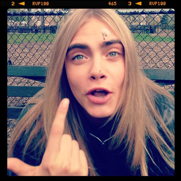 Cara Delevingne: Ποιος την σημάδεψε στο πρόσωπο;